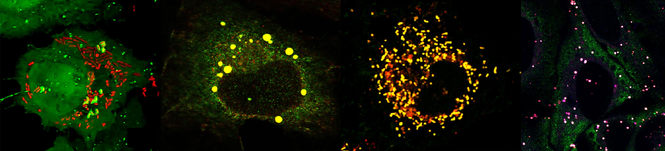 Autophagy Cellular Mechanisms And Significance In Health And Disease