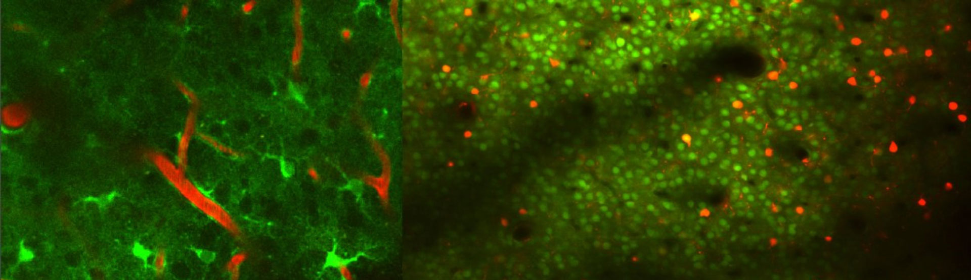 Two-photon imaging of brain dynamics: Illuminating neuronal and glial ...