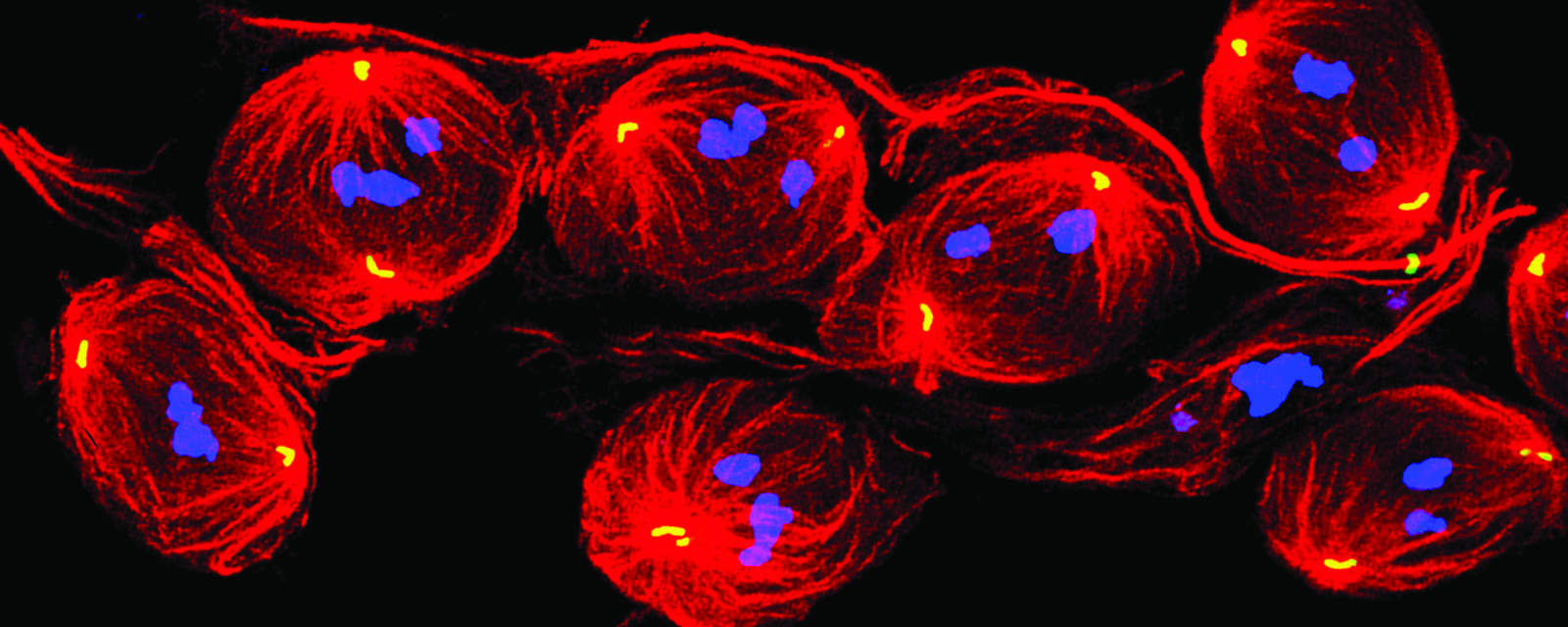 Chromosome segregation and aneuploidy