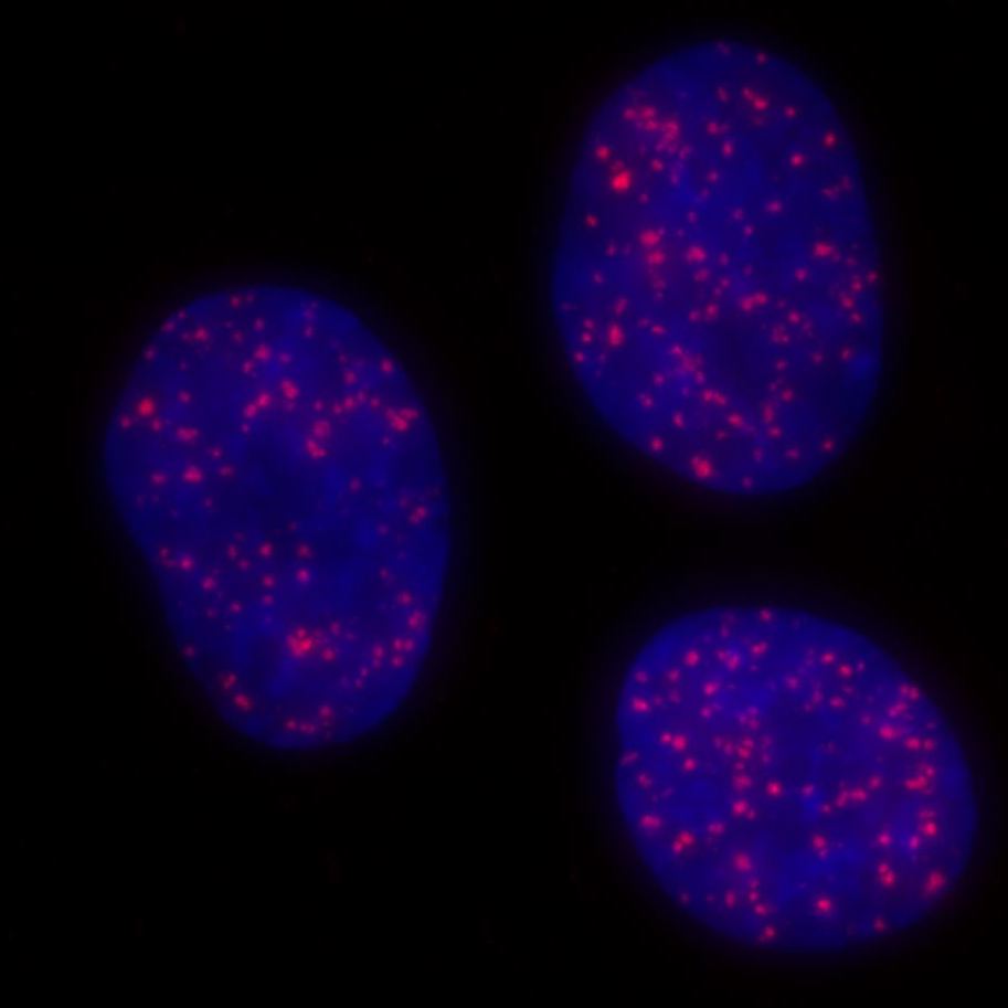 The DNA-damage response in cell physiology and disease