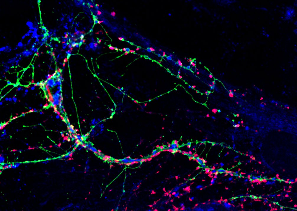 Autophagy in brain health and disease