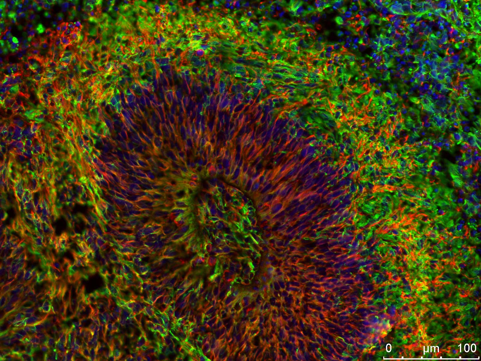 Modeling development and disease with human tissue organoids