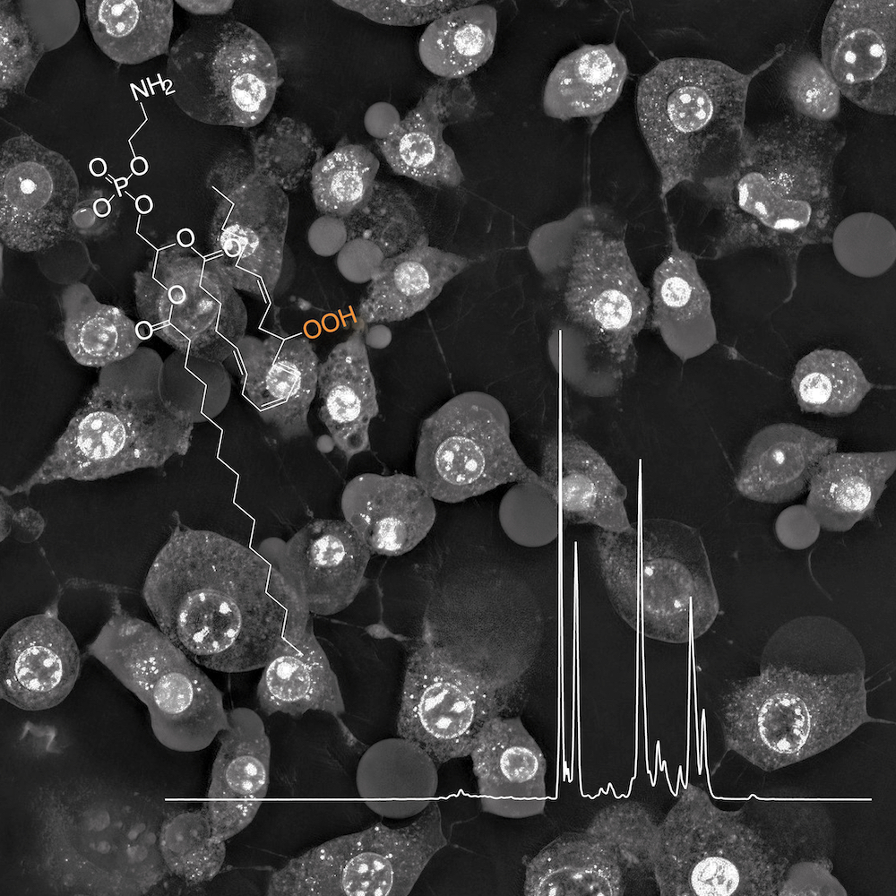 Ferroptosis: When metabolism meets cell death