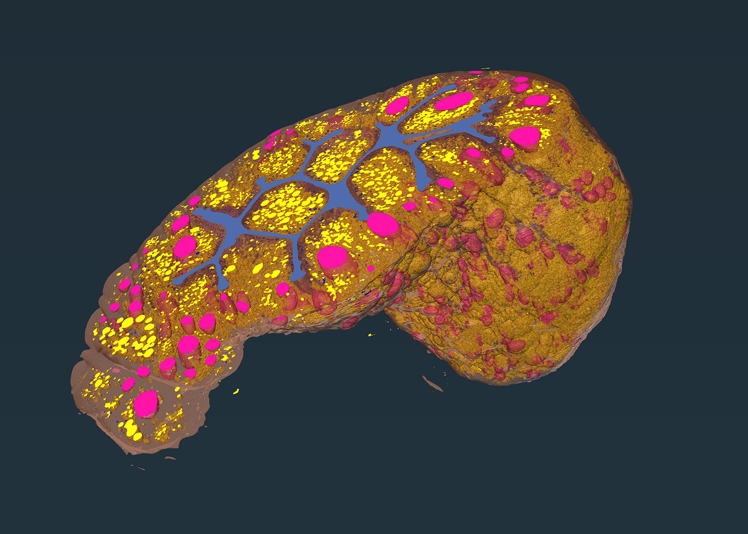 Advanced analysis and processing of volume electron microscopy data